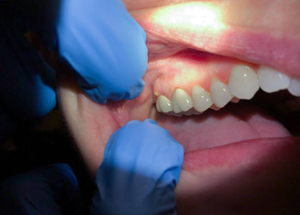 Best Emergency Cosmetic Dentistry in Universal City, TX