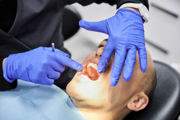 Best Broken or Cracked Tooth Emergency Dentist in Universal City, TX